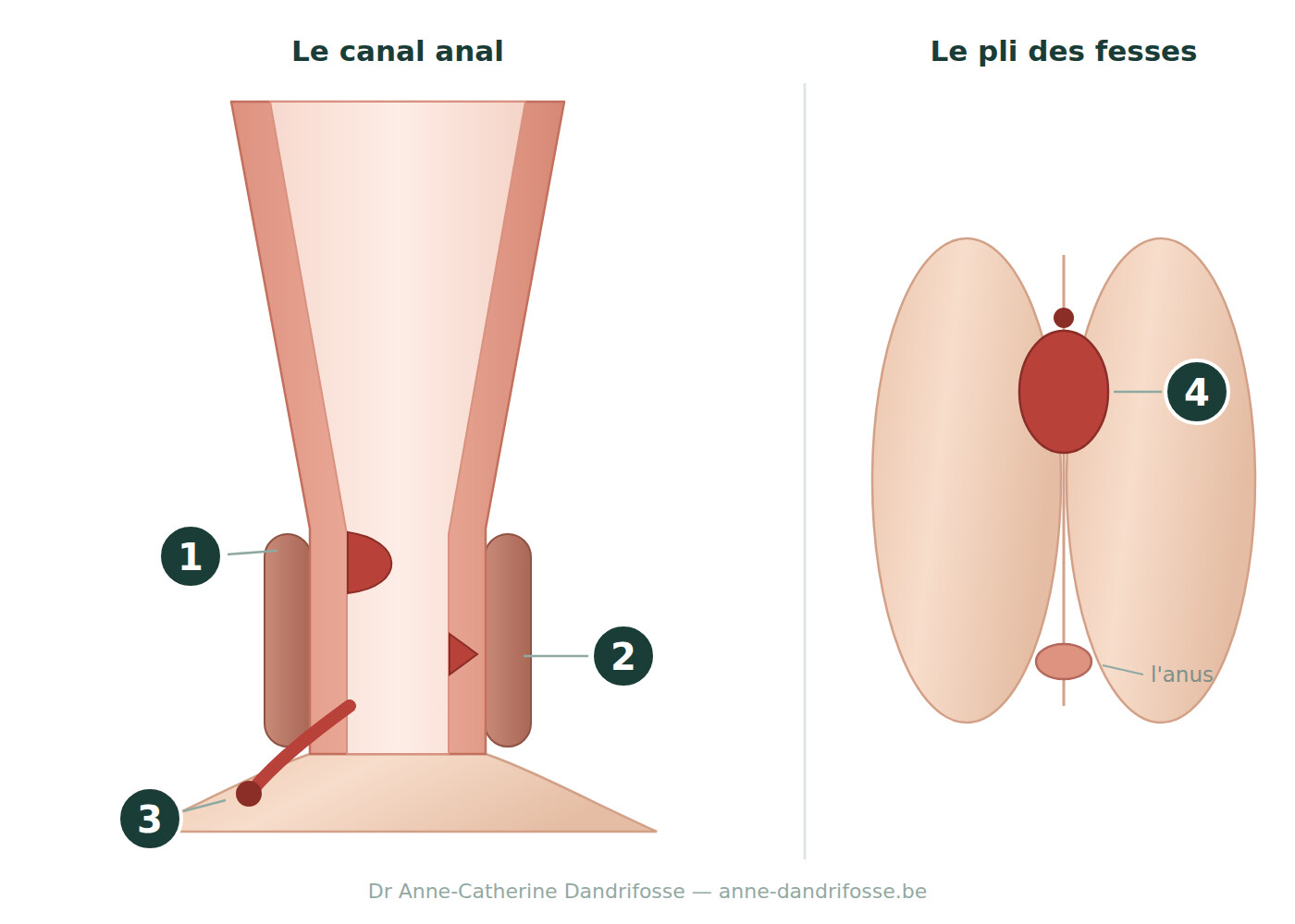 Sch&eacute;ma num&eacute;rot&eacute; des affections proctologiques : h&eacute;morro&iuml;des, fissure anale, fistule et kyste pilonidal