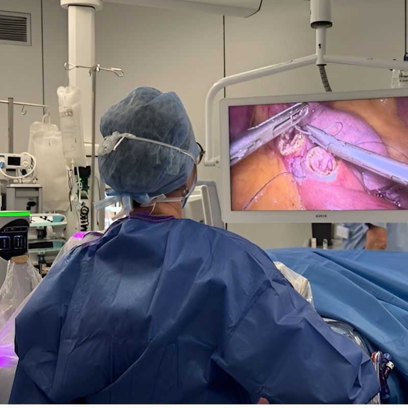 Comparaison entre sleeve et bypass gastrique à Bruxelles