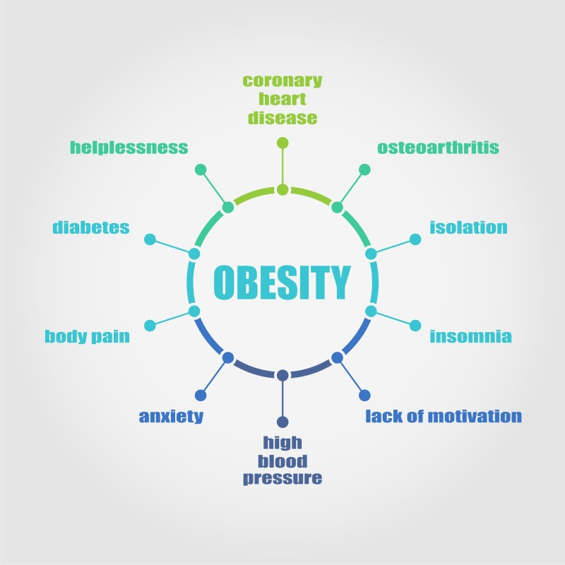 Conditions to fulfil to be operated for obesity