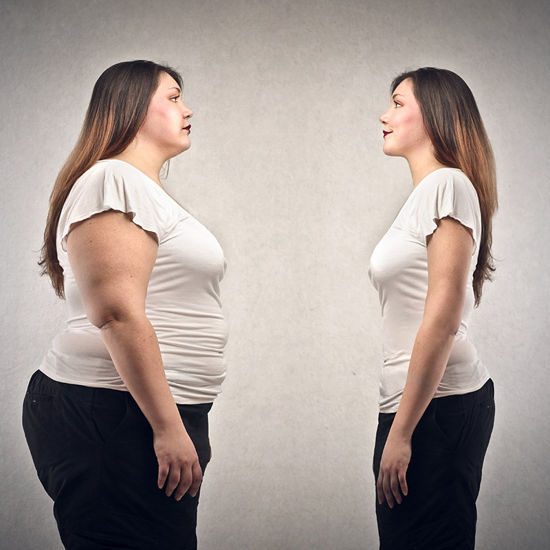 Obésité : quand faut-il se faire opérer ?